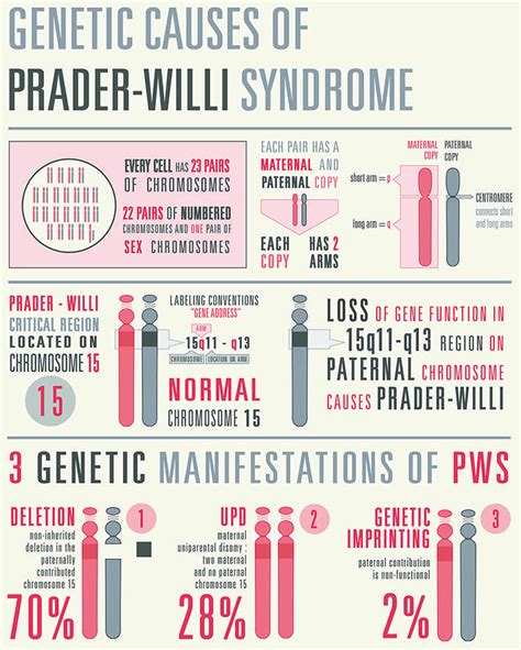 prader willi syndrome prognosis